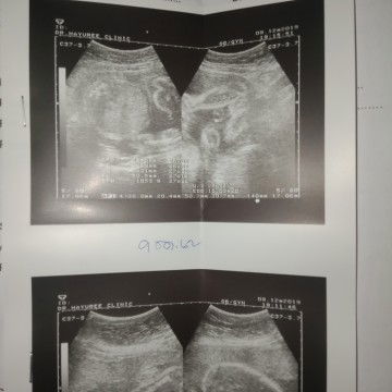 8/03/63 กำหนดคลอด 