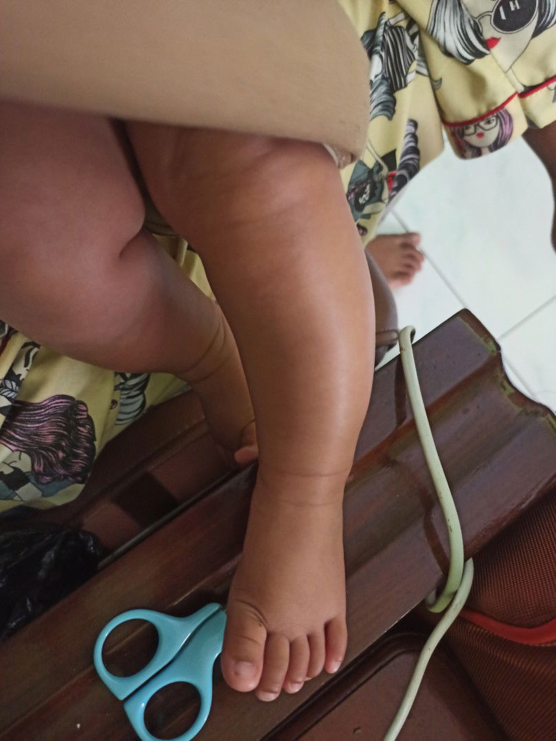 kaki anak