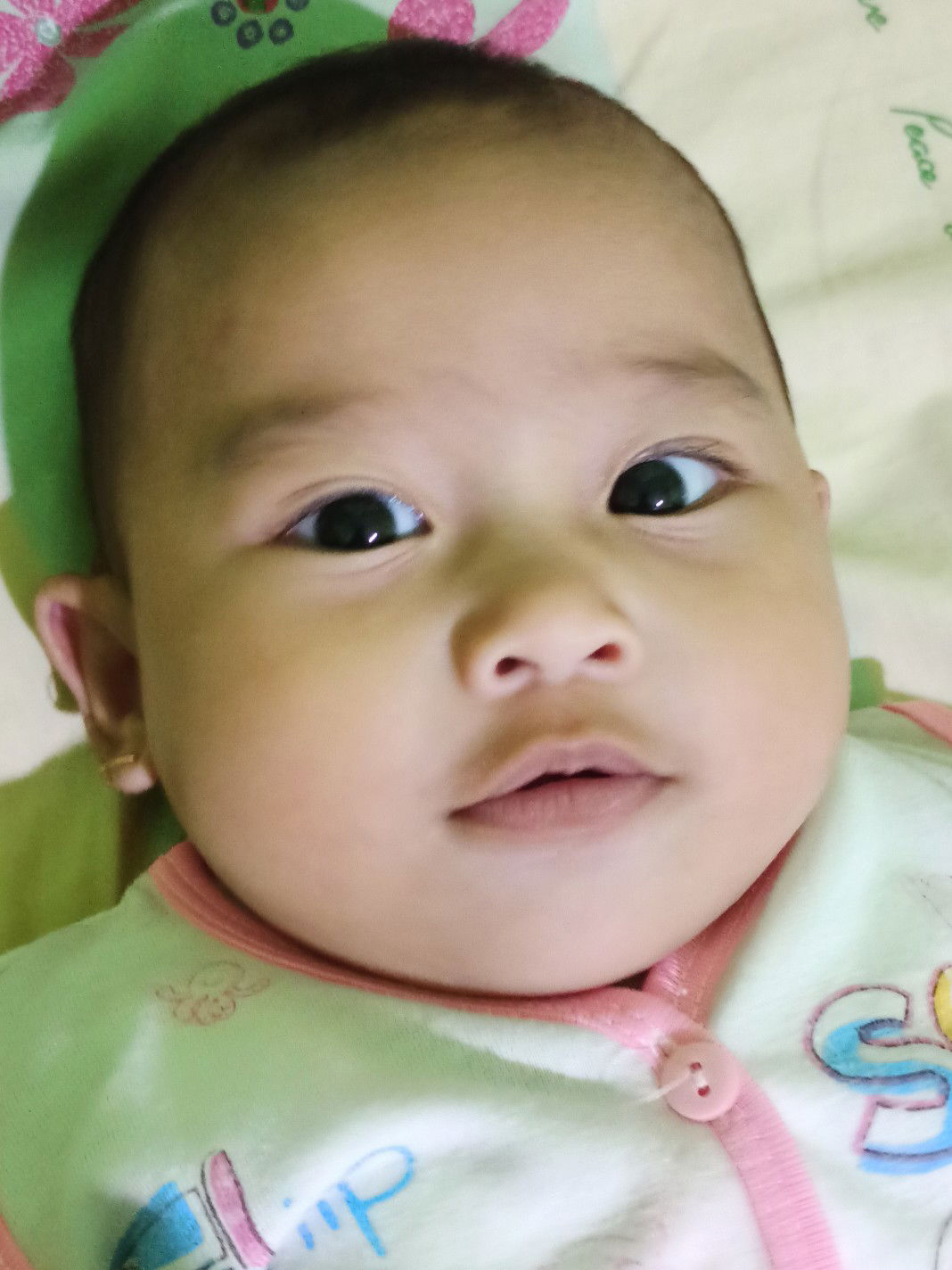 mata anak ku apakah juling?