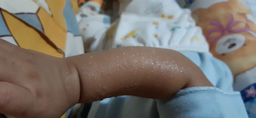 Dd keluar keringat setiap dbf