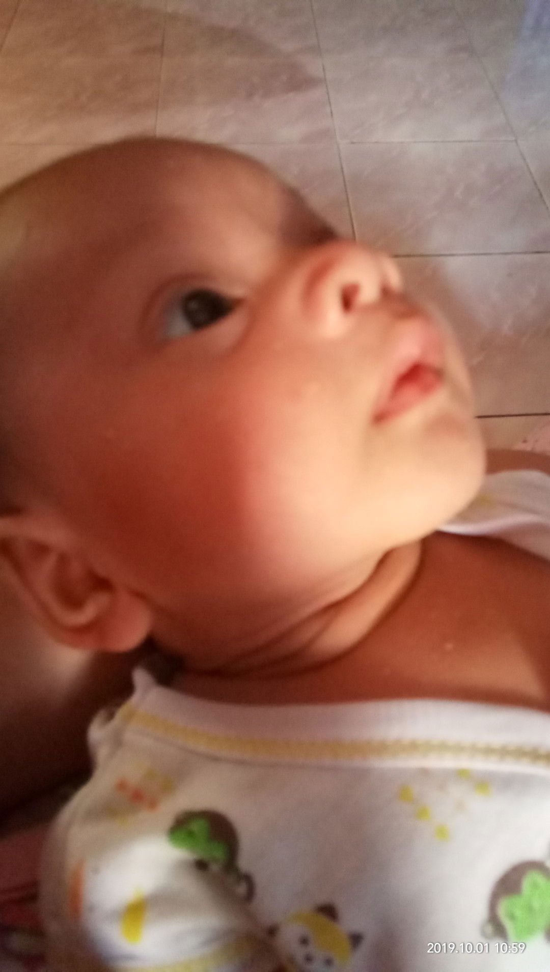 bintik bintik putih pada bayi