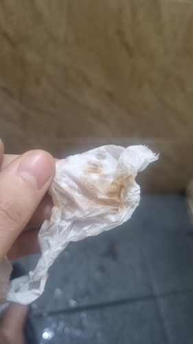 Keluar flek cokelat di week 14 apakah wajar bun?