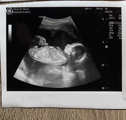 อยากรู้เพศลูกค่ะ