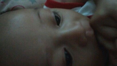 bercak putih Di wajah