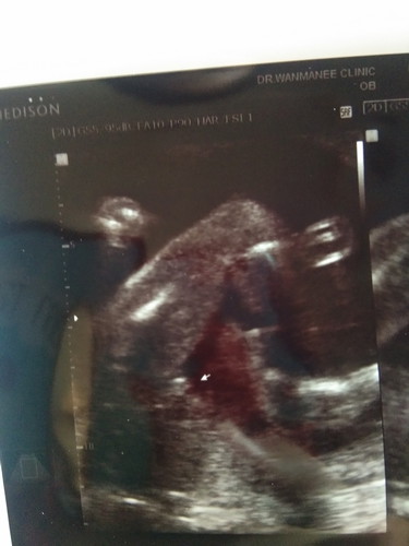 ลูกชายหรือลูกสาว