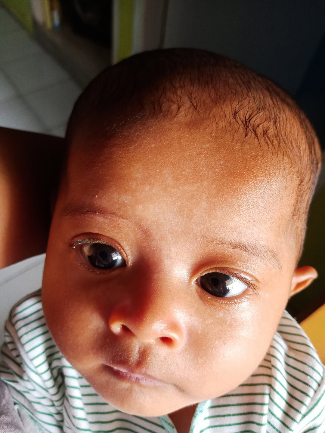 bercak putih