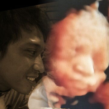 terlove... suka bgt memandang hidungnya makin jatuh cinta ???