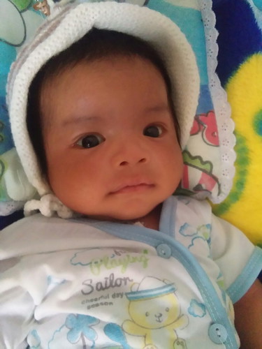 Bibir bayi kering