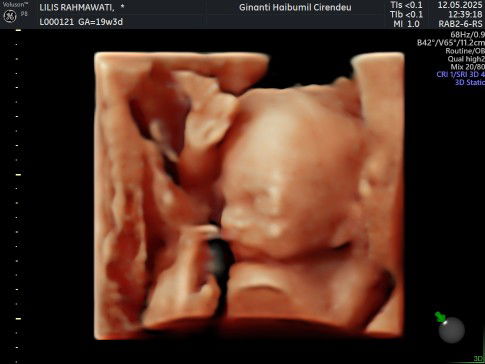 Lilis Rismawati profile icon