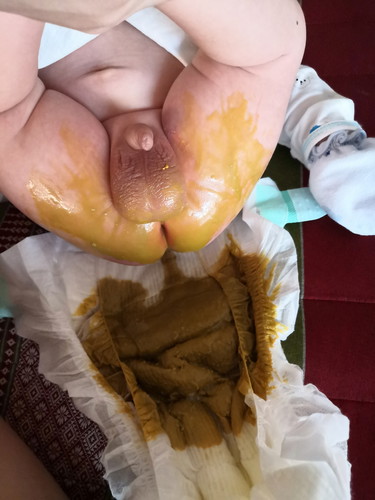 อึ ของน้อง แบบนี้ปกติมั้ยค่ะ