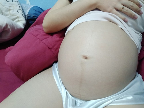หกเดือนแล้ว มีแต่คนทักว่าท้องเล็ก