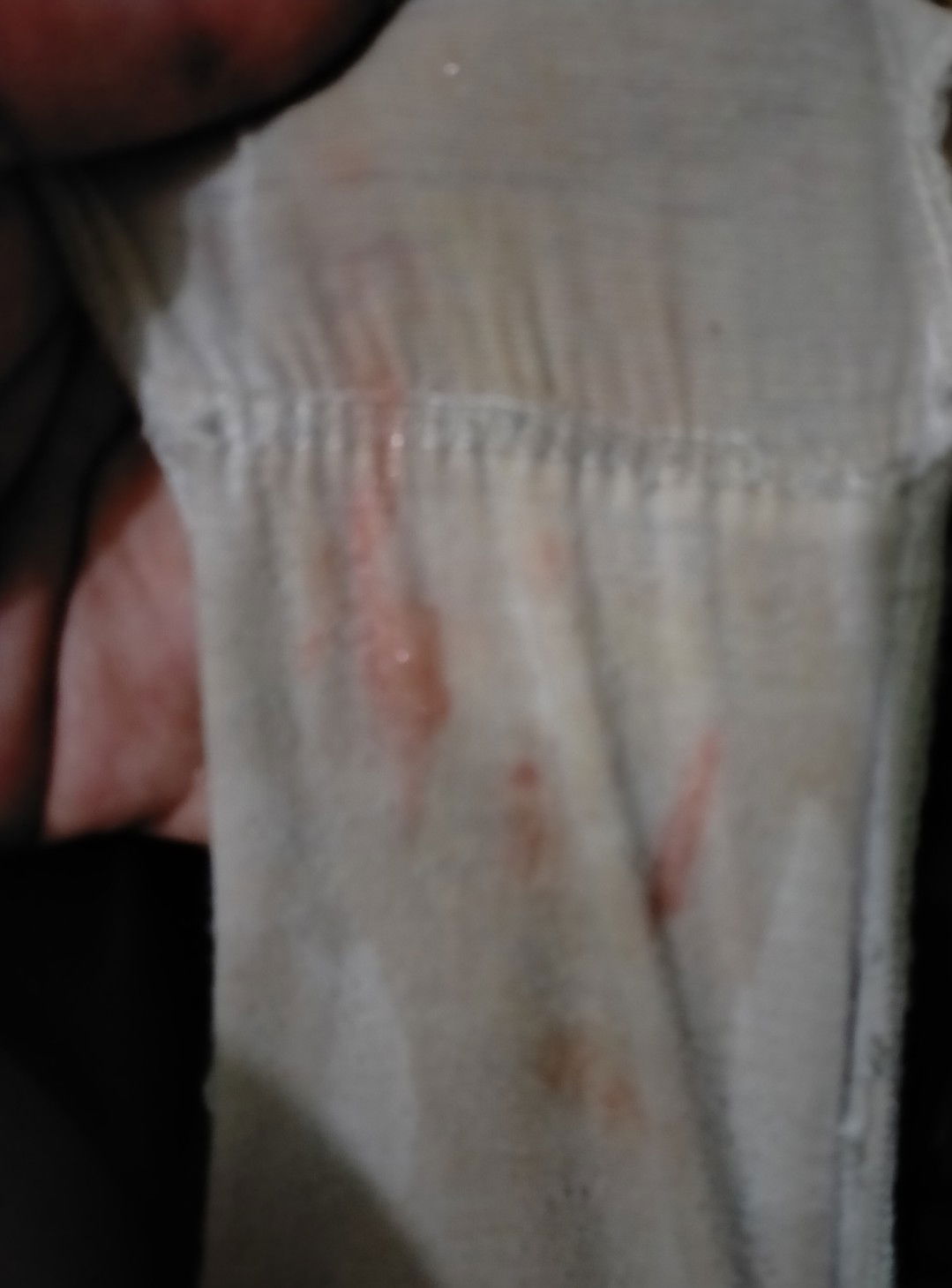 yg jijik jg d liat ya?