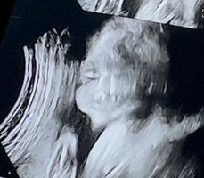 wannakorn profile icon