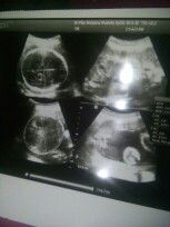 mau sedikt nanya nih bun