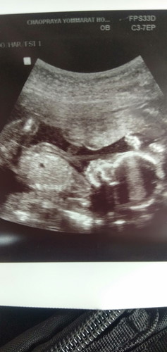 ซาวด์ครั้งแรก