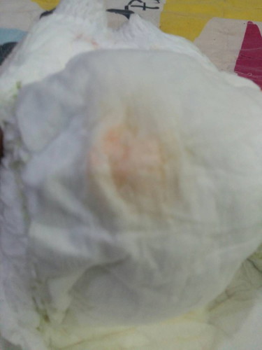ฉี่น้อง