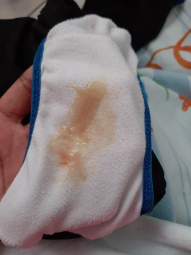 HOW CAN I MAINTAIN CONTINUOUS CONTRACTION?