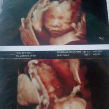 menantikan kehadirannya??