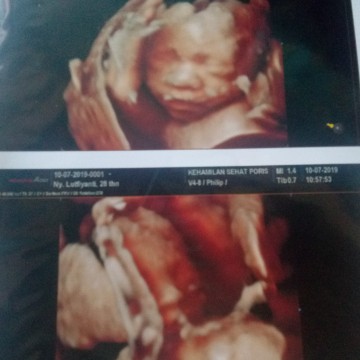 menantikan kehadirannya??