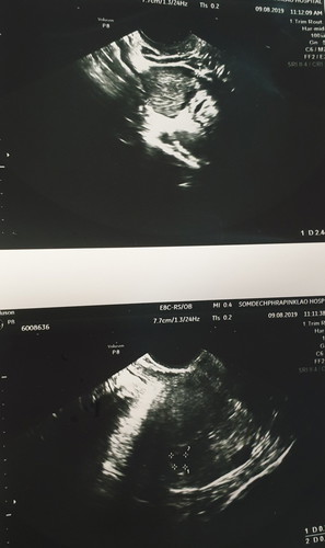 ซาวด์ครั้งที่2ยังไม่พบ