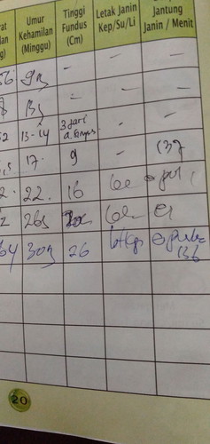 posisi janin