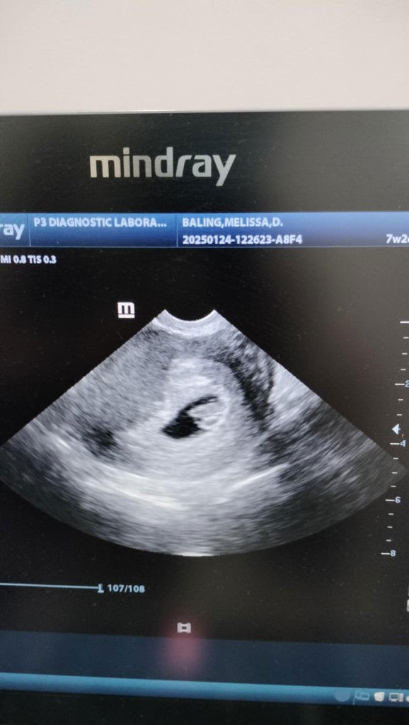 melissa baling profile icon