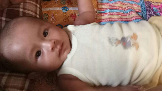 telapak tangan dan kaki selalu keringetan