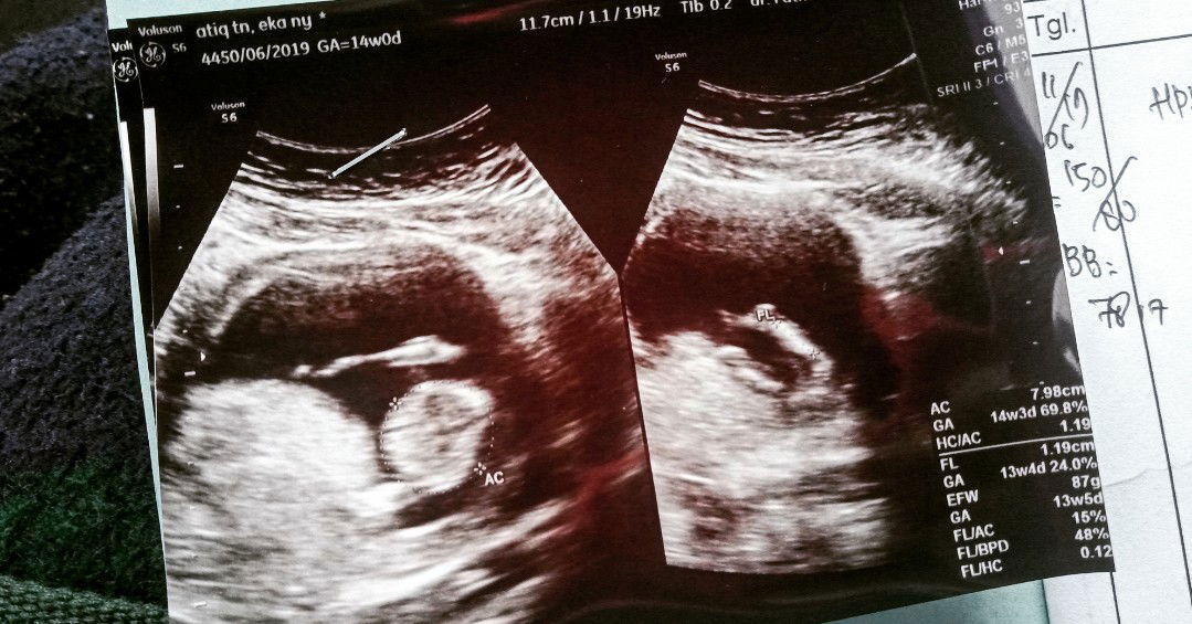 Jangan sering periksa ke dokter!