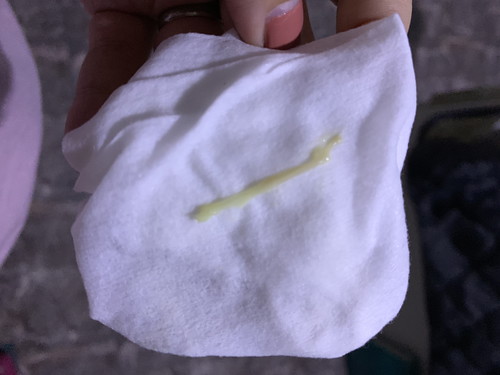 Vaginal discharge