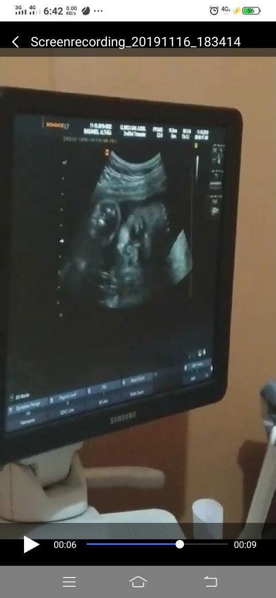 Althea Grace Basañes profile icon