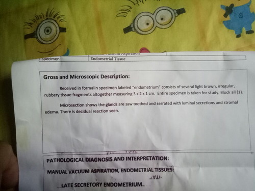 ano poh b ibigsabihin nito