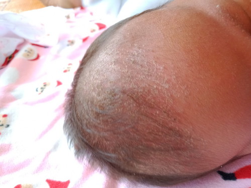 สอบถามค่ะ