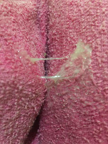 มูกใสหรืออะไรคะ