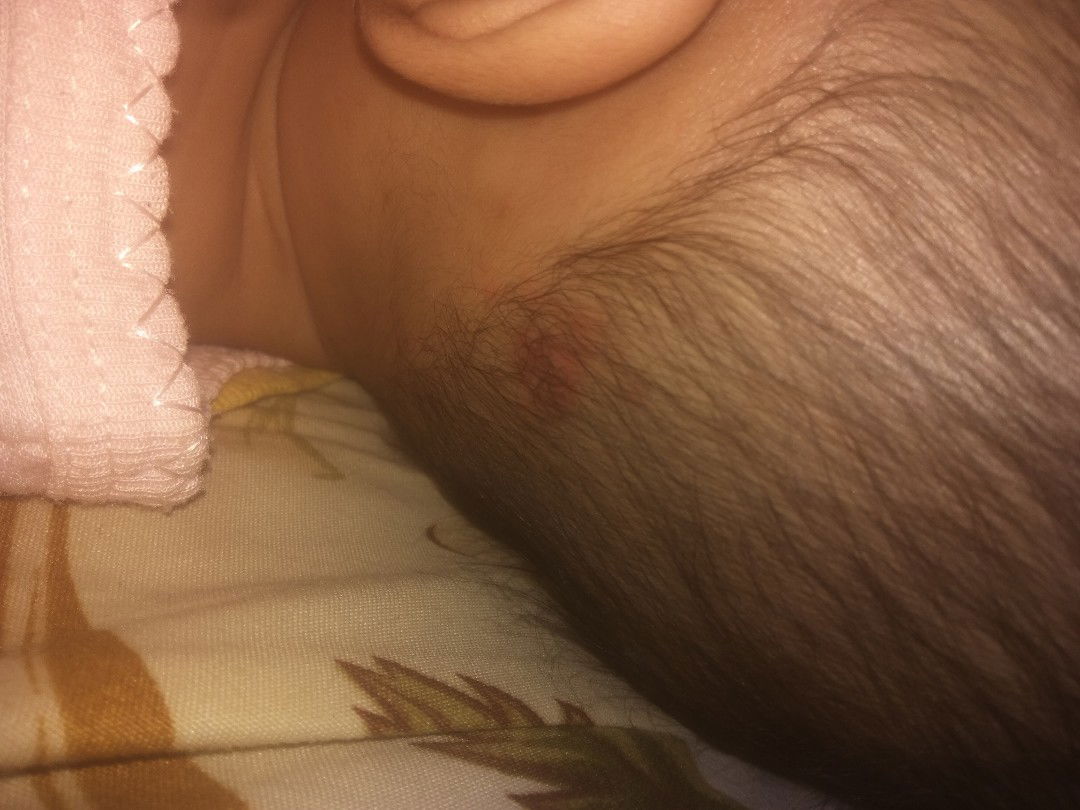 sakit ini obatnya apa yah untuk bayi usia 5 bln