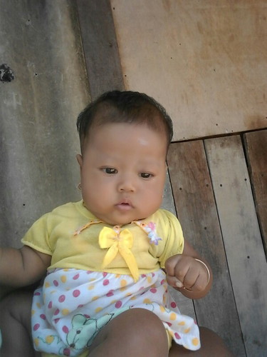 kepala anak