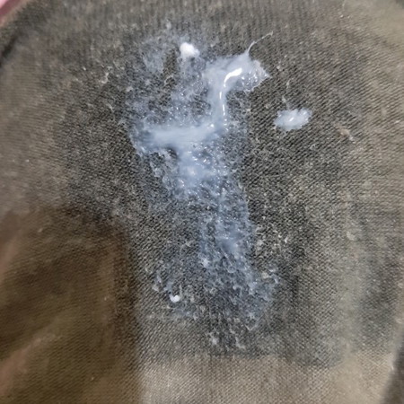 discharge/mucus milky white na parang sipon