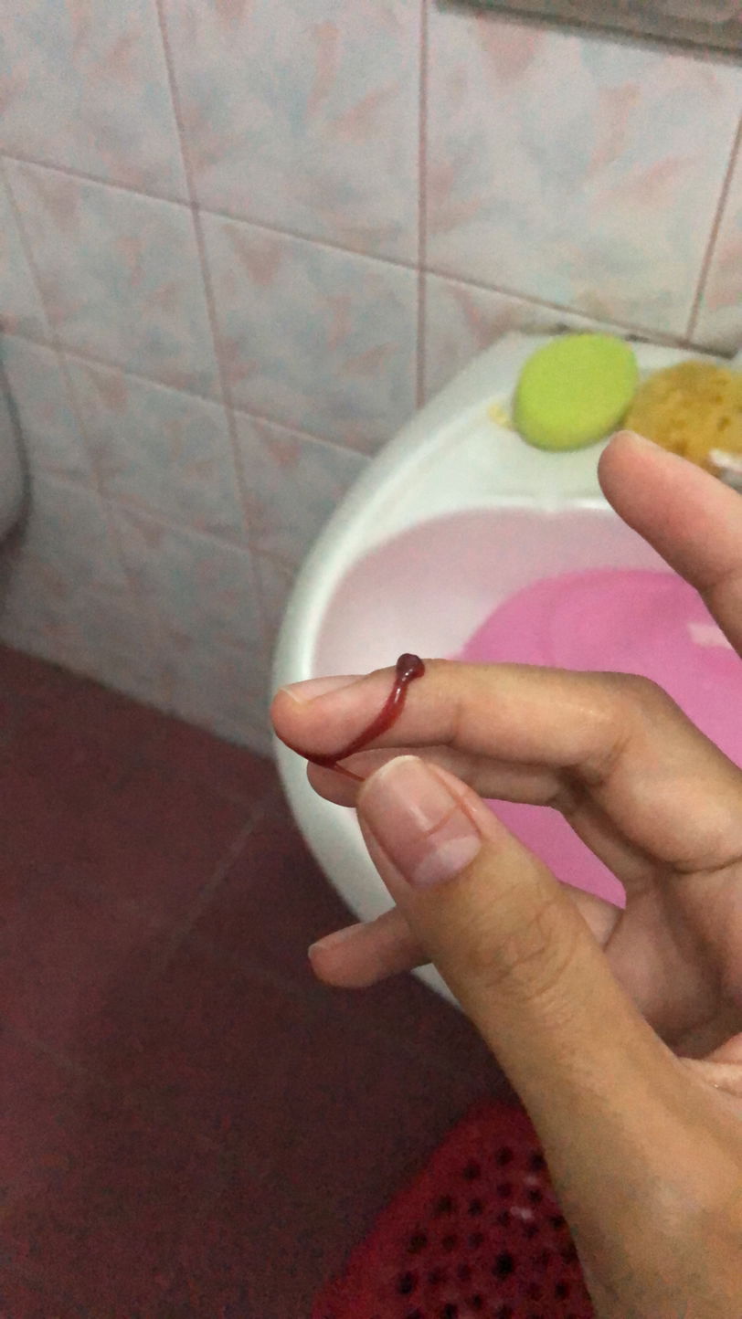 ประจำเดือนหรือน้ำคาวปลาคะแยกไม่ออก?