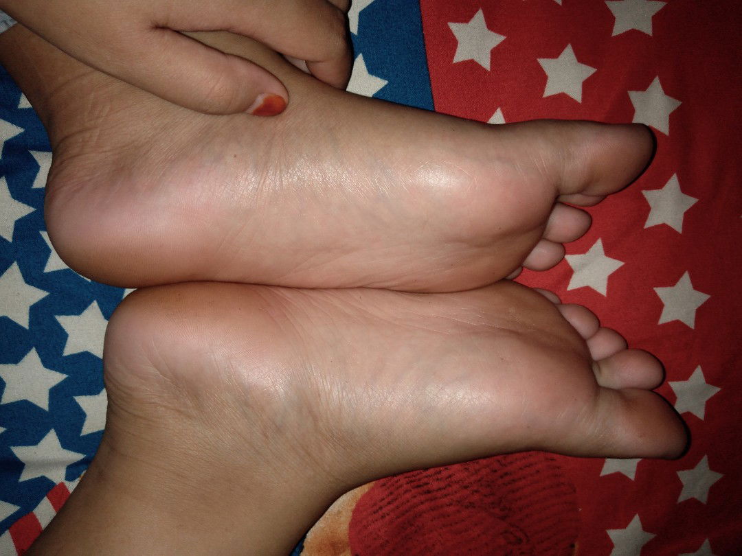 telapak kaki bengkak