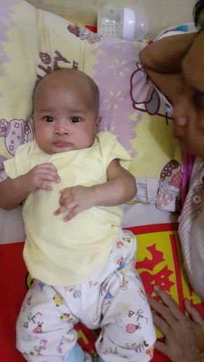 anak sering nangis dan perut nya kembung