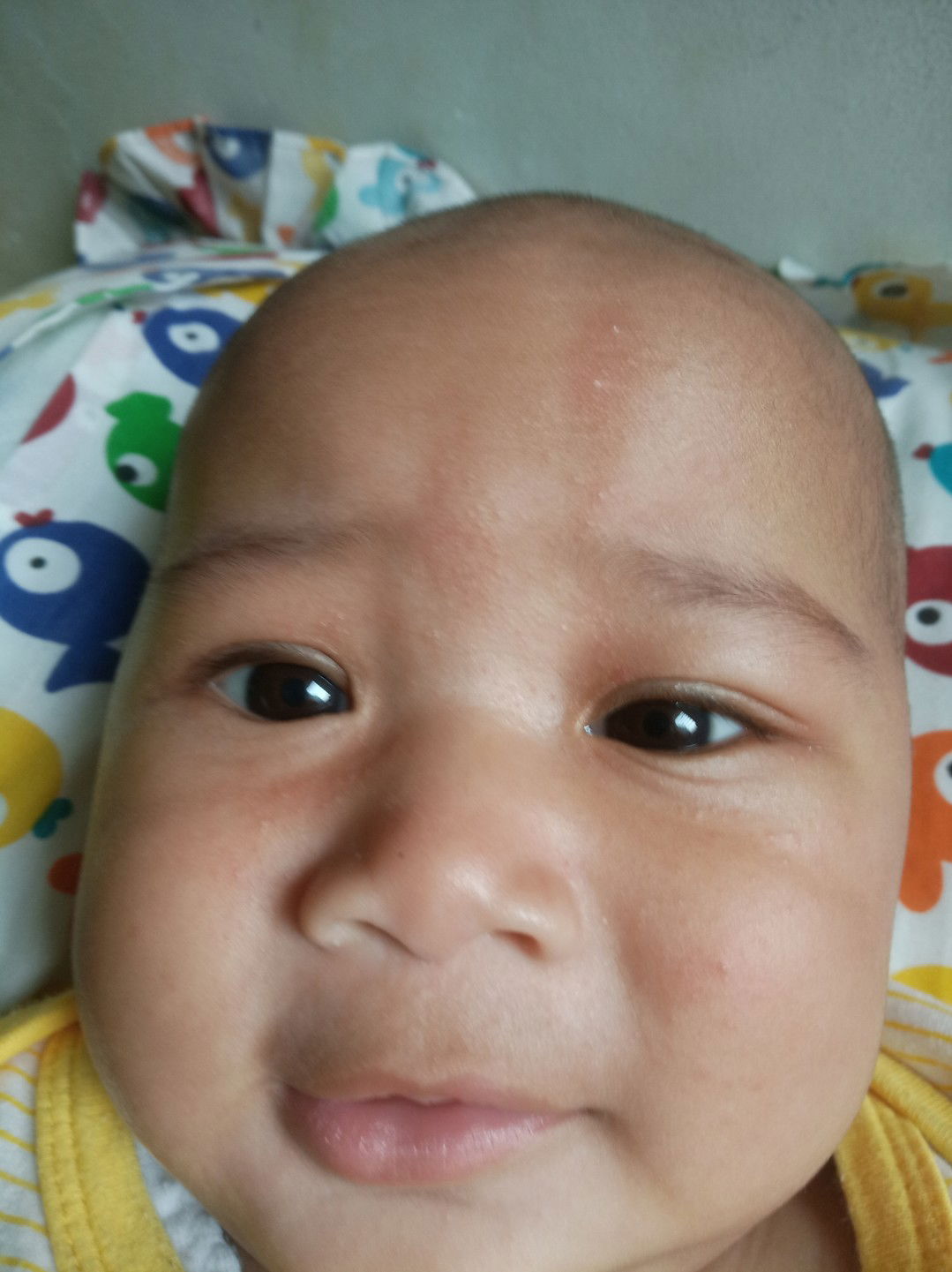 bintik merah di pipi