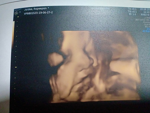 น้ำคล่ำน้อย