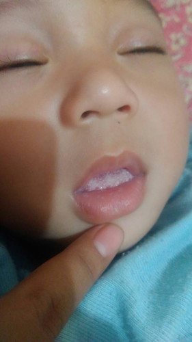 jamur ato bekas susu??