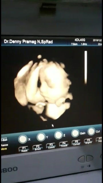 Ema Zet Pe profile icon