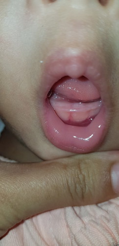 BAYI TUMGI