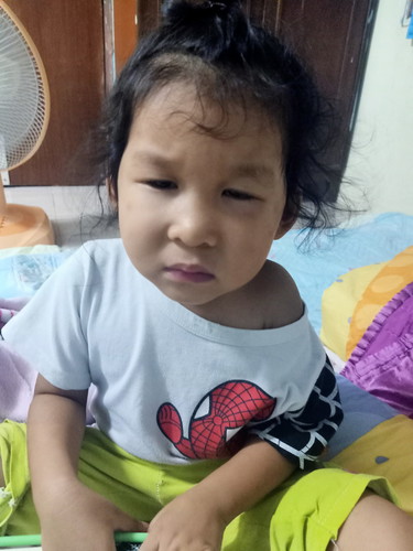 ลูกสาว3ขวบมีขี้ตาแฉะตลอดเวลามีน้ำมูกนิดหน่อยอยากทราบสาเหตุค่ะ