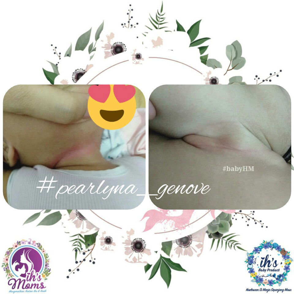 masalah ruam berkurang