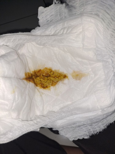 PUP BAYI OTW 5 BULAN