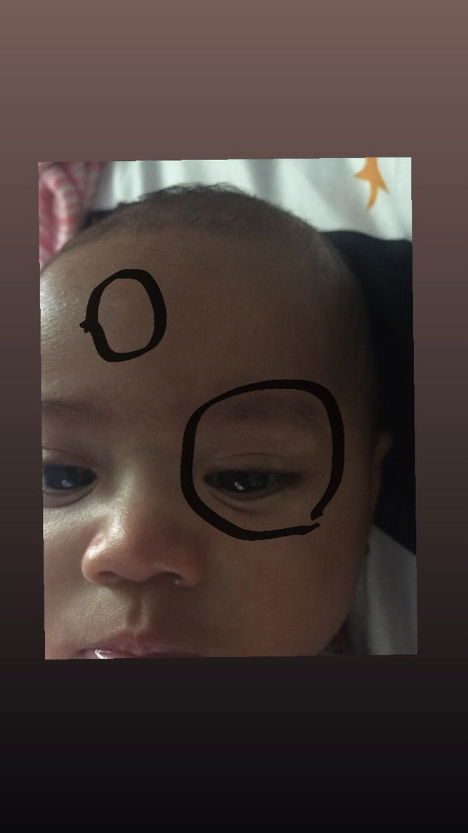 Bintik putih diwajah