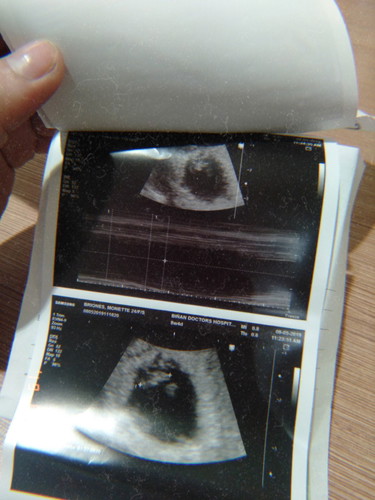 6weeks and 4days