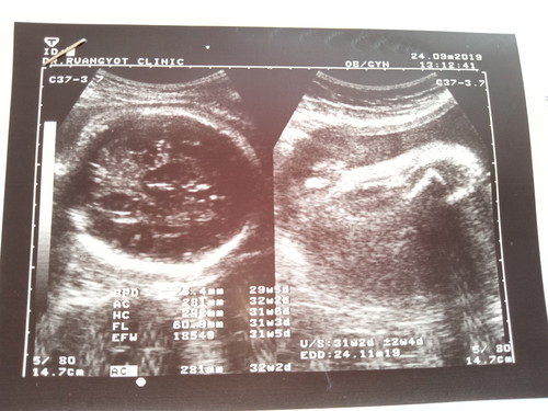 31+5วีคแล้วค่ะอยากถามแม่ๆที่รู้นะค่ะ